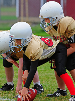 mouthguards